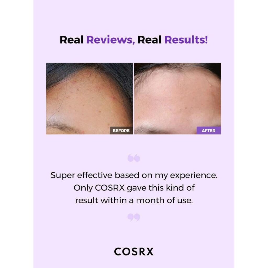 Cosrx - Aha/Bha Clarifying Treatment Toner