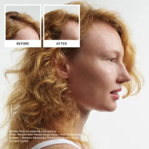 Nioxin - System 1 Kit (300+300+100)