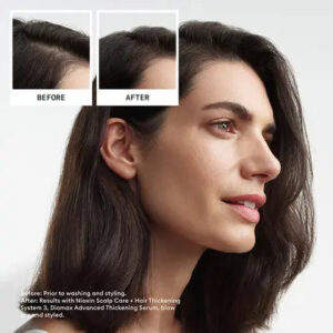 Nioxin - System 3 Kit (300+300+100)